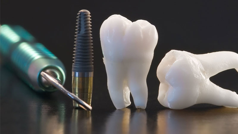 Implant